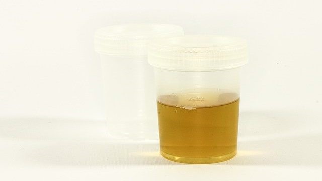 Synthetic Urine Where To Buy Fitzgerald Detroit MI